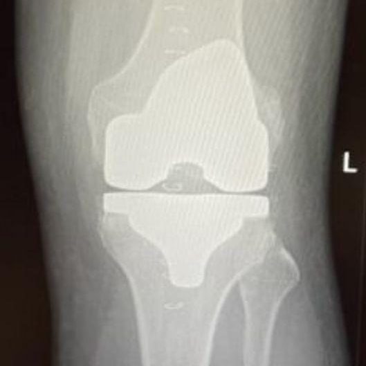 Dr Mike Terreblanche | Orthopaedic | Cape Town