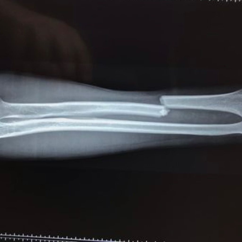 dr-terreblanche-services-page-treatments-section-adult-paediatric-trauma3